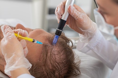 Hair Restoration